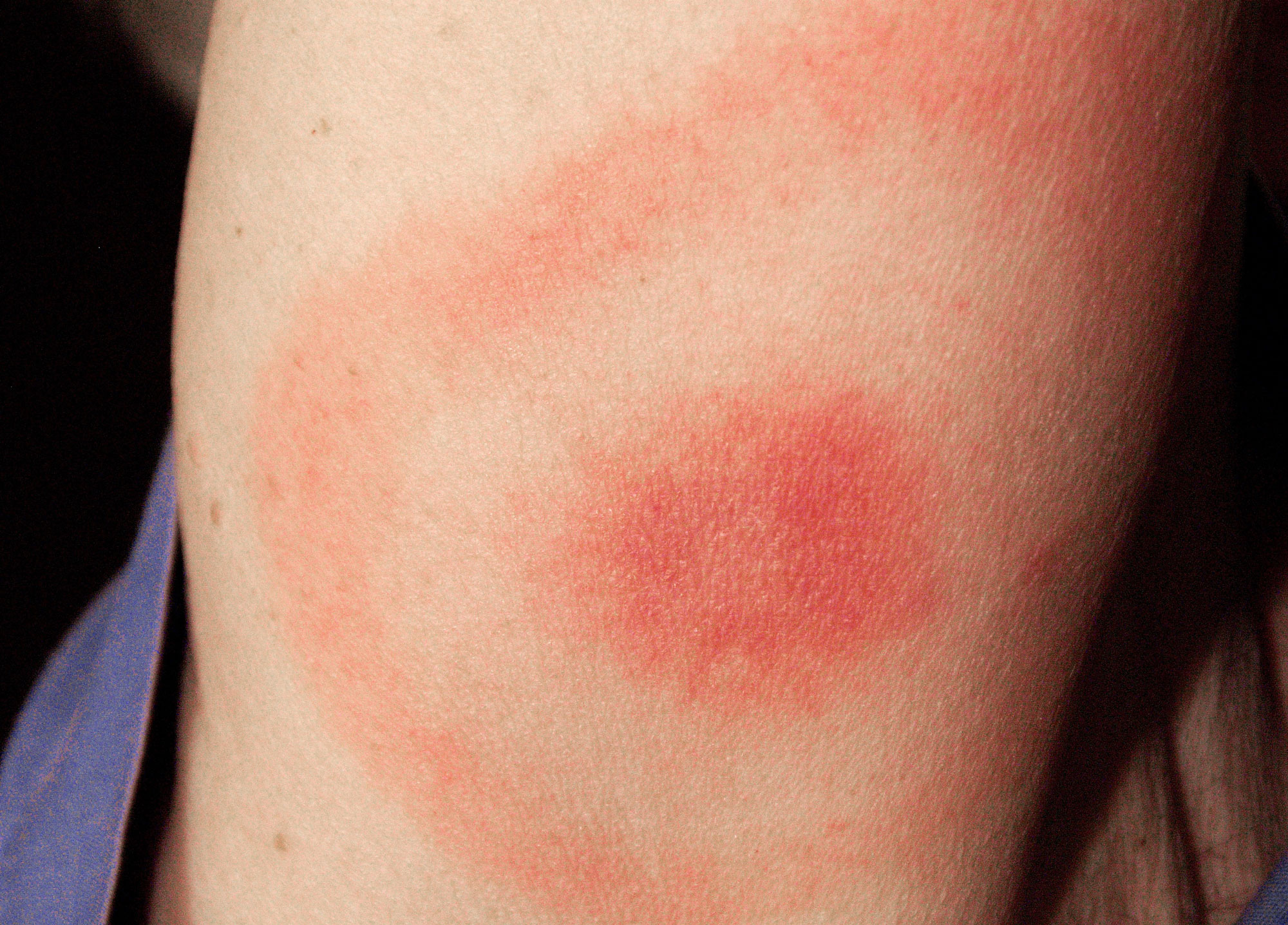 Pictures of What Bed Bugs Look Like Photos of Pictures of What Bed Bugs Look Like Photos of